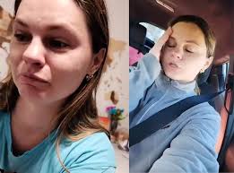 Anna Campisi Before vs After her gastric sleeve surgery 😳