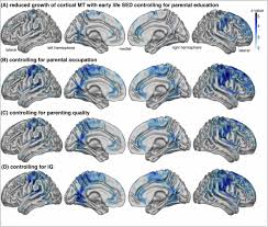 Here's what to know about this normal—albeit exhausting—newborn phenomenon. Childhood Socio Economic Disadvantage Predicts Reduced Myelin Growth Across Adolescence And Young Adulthood Biorxiv