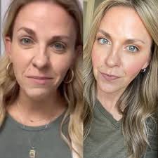 Skincare Routine and Product Recommendations for Healthy Skin