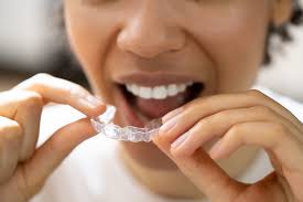 The Ultimate Guide to Transforming Your Smile with Invisalign | Mountain  View Advanced Dental Mountain View, CA