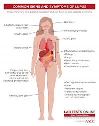 Extractable Nuclear Antigen Antibodies Ena Panel Lab Tests Online