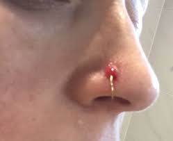 Does Himalayan Salt Help Piercing Bumps | Tiktok