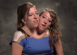 Read on 7, he was engaged. Who Is Abby Hensel Dating Abby Hensel Boyfriend Husband