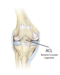 A network access control list (acl) is an optional layer of security for your vpc that acts as a firewall for controlling traffic in and out of one or more subnets. Anterior Cruciate Ligament Acl Surgeon In San Francisco Gordon Lundy Md