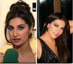 Eski Hali Soke Etti Ebru Yasar In Gozleri Haric Her Yeri Estetik Cikti Magazin