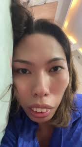 #stitch with @Ella Roxas 👩🏽‍⚕️ Walang preno ang mouth ni Doc