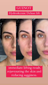 ❗️Only This Week❗️ , ❤️Mother’s...