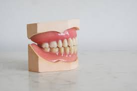 Wisdom teeth, also known as third molars, sometimes cannot erupt completely above the gum due to the ever decreasing size of the human jaw. How To Know When It S Time To Get Wisdom Teeth Removed Peak Dental