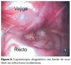 Pin En Medicina Para el fundador de la teratología mexicana, el hermafrodita estaba muy lejos del absoluto hay un momento en el que el ser humano no es hombre ni es mujer. pin en medicina