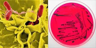 Examine plates for presence of colonies suspected to be salmonella. Morphology Culture Characteristics Of Salmonella Typhi S Typhi