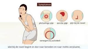 4 blindedarmontsteking bij kinderen en jongeren. Blindedarmontsteking Symptomen En Operatie Youtube