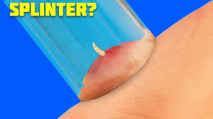 After you've resisted the urge to squeeze, find a potato and cut it into slices. 37 Smart Life Hacks Youtube