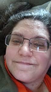 Cystic Fibrosis and Selenium Supplements