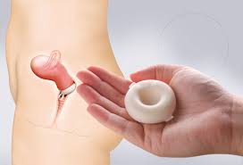 نتيجة بحث الصور عن ‪birth control‬‏