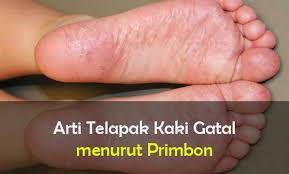 Telapak tangan kiri gatal maupun telapak tangan kanan gatal yang dialami bisa saja tidak langsung terasa karena pada beberapa kasus, gatal baru terasa setelah beberapa jam terpapar.selain itu, reaksi alergi juga mungkin baru muncul setelah paparan berulang. Arti Telapak Kaki Gatal Menurut Primbon Jawa Dan Islam Arti Mimpi Kedutan
