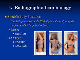 The position property specifies the type of positioning method used for an element (static, relative, absolute, fixed, or sticky). Introduction Of Radiographic Technology I Radiographic Terminology Ii Basic Imaging Principles Iii Positioning Principles Iv Digital Imaging Ppt Download
