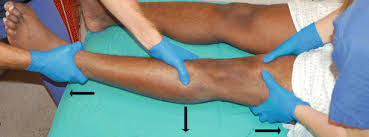 Jun 04, 2021 · first, get into a staggered stance. Knee Dislocation Reduction Springerlink