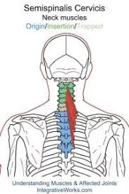 Semispinalis Cervicis Functional Anatomy Integrative Works Trigger Points Trigger Points Neck Neck Ache
