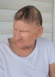 Everett Burchett Obituary (1962