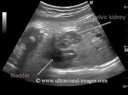 Pin On Ob Gyn Utrasound 301 Mod 4