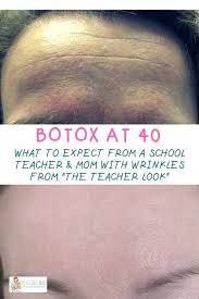 How long does botox take to work? Botox Aftercare What To Expect After Botox First Time Botox The Gifted Gabber Botox Botox Before And After Forehead Botox