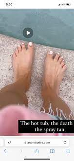 WHY do her toes look like this???? : r/MalloryErvinSnark