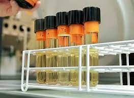 Te explicamos los síntomas, cómo se en definitiva, infección de orina o del tracto urinario son expresiones que engloban diferentes enfermedades. Examen De Orina Uroanalisis Laboratorio Clinico Martinez Santa Marta Barranquilla Cienaga