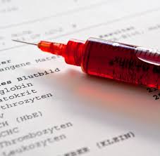 Bluttest Was Arzte Alles Im Blut Lesen Konnen Welt