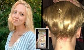 Streak a couple of layers, or get a heavy blonde chunk, the trendy blonde will cool short hair treated with back blonde highlights with black front bang. Teenager Who Used Hair Dye To Turn Her Roots Blonde Is Left With Bald Patches And Chemical Burns Daily Mail Online