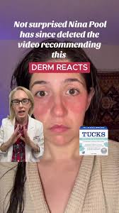 Can You Use Tucks Witch Hazel Pads