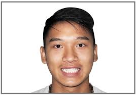 Before and After Braces and Invisalign