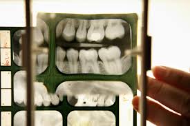 Regular dental exams are an important part of preventive health care. You Probably Don T Need Dental X Rays Every Year The New York Times
