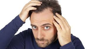 Voir plus d'idées sur le thème coiffure homme calvitie vous vous demandez quelle coupe tendance homme va bouleverser l'année à venir?on vous en présente plusieurs que vous pourrez adapter à. Calvitie Naissante Court Long Quelle Coiffure L Express