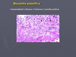 H hérba, hábitus, hépar, húmerus, hemiplegía, hyoídeus, histológia, hómo, hirúdo, hygiéna, hérpes, inhalátor, hydrocyánicus. Curso Trianual De Cardiologia Ppt Descargar