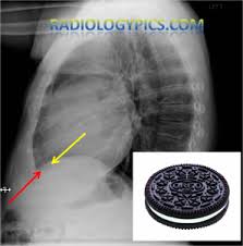 Pin On Excalibur Healthcare S Imaging Teleradiology Pins