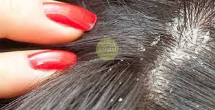 Sactaki Egzamayi Geciren Mucize Organik Zamani Beauty Health Beauty Ear Cuff