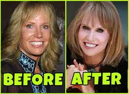 Apr 17, 2018 · dr. What Happened To Monica Quartermaine Leslie Charleson On General Hospital Know Her Age Net Worth Eceleb Gossip