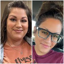 Maxie has lost weight. She looks amazing!