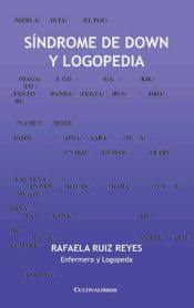 SINDROME DE DOWN