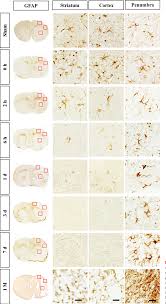 Proteins are the doers in the human cell, executing many functions that together enable life. Pdf Spatiotemporal Protein Atlas Of Cell Death Related Molecules In The Rat Mcao Stroke Model Semantic Scholar