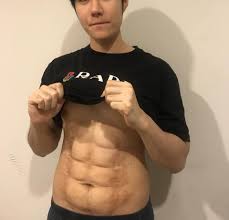 6 pack fitness, american fork, utah. Instantly Turn Your 1 Pack Into A 6 Pack With This Cosmetic Surgery At A Bangkok Hospital