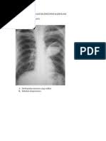 Contoh soal radiologi dan jawabannya. Latihan Soal Radiologi