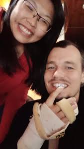 Funny Toothless Husband