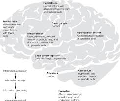 Neurological Phenotypes For Down Syndrome Across The Life Span Semantic Scholar