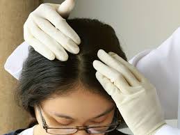 Acne is a disorder of the glands which lie at the base of hair follicles. Scalp Acne Treatment Causes And Prevention
