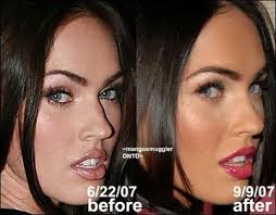 She was born in oak ridge, tennessee. Megan Fox Nase Job Vor Und Nach Megan Nose Job Nose Job Cost Celebrity Plastic Surgery