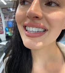 Grillz for Missing Teeth