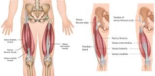 Imbalance between muscle and tendon properties. Upper Leg Pain Kinesiology Sports Tape