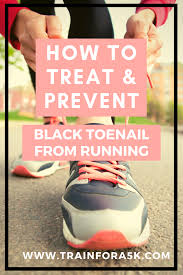 How To Treat And Prevent Black Tails From Running Runners Toenails Can Become A Painful Issue Deal Runners Toenails Running Injuries Cross Training Workouts