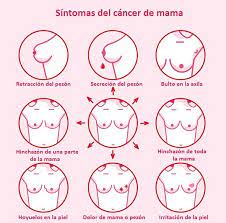 Sintomas Del Cancer De Pecho Y Su Deteccion Precoz Tu Canal De Salud